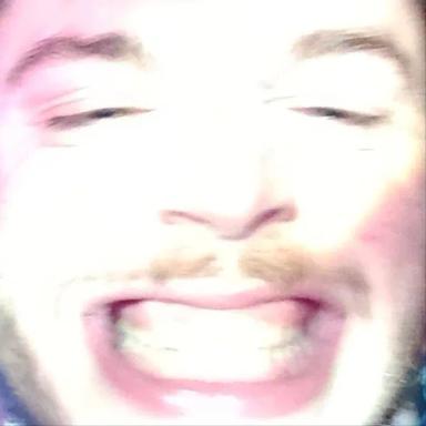 FP
