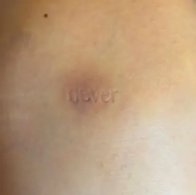 IM