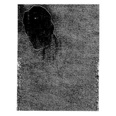 AP