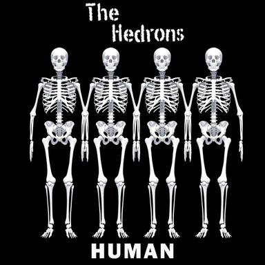 MH